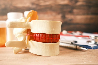 先天的な要因によるもの